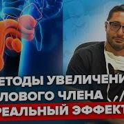Член