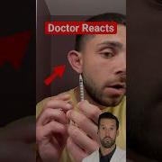 Cauliflower Ear