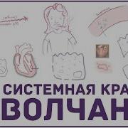 Скв