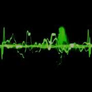 Mt Eden Dubstep Still Alive