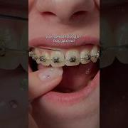 Ttmdzybis30