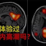 颅内高潮